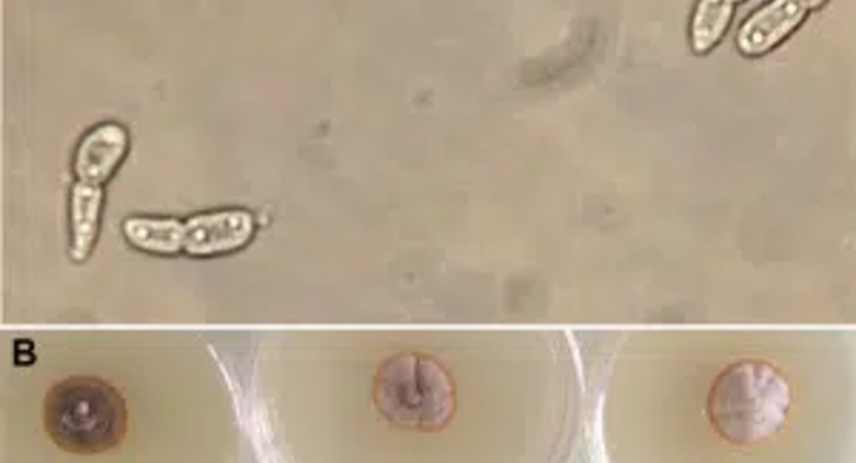 marsonia au microscope